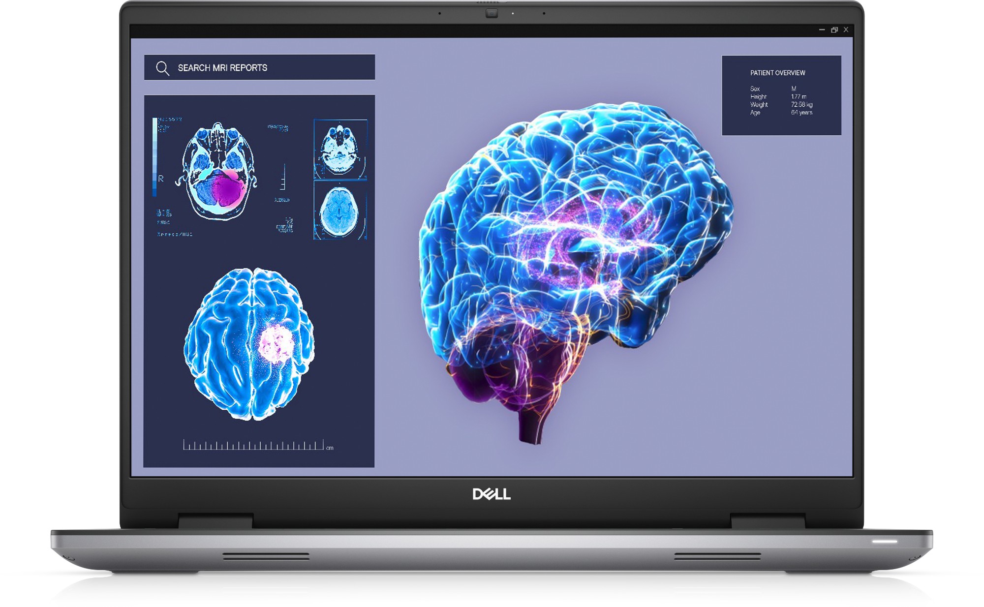 hHeWHmyrFkiwCpjM8tTkyA.c-r.jpg DELL Precision 7680 Intel Core i9 i9-13950HX Mobile workstation 40.6 cm (16") Full HD+ 32 GB DDR5 1 TB SSD NVIDIA RTX 3500 Ada Wi-Fi 6E Windows 11 Pro Grey (MVHK0)